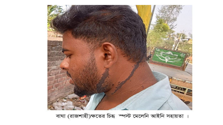 ক্ষতের চিহ্ন বয়ে বেড়ালেও মেলেনি আইনি সহায়তা...