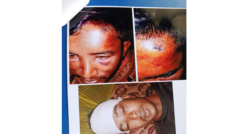 ট্রাক্টর চালককে কুপিয়ে হত্যার চেষ্টা, ১০ দিনেও হয়ন...