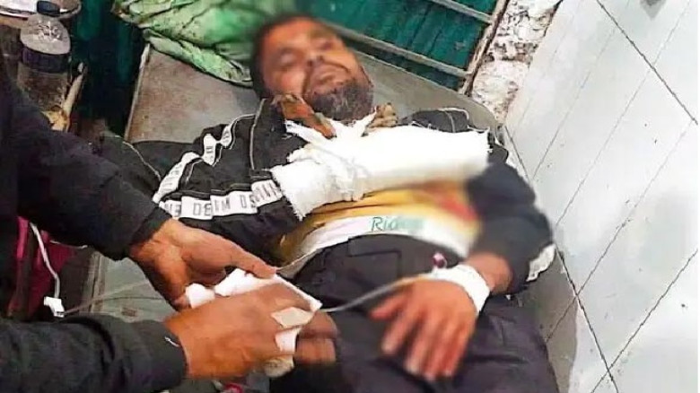 গাইবান্ধায় দুর্বৃত্তদের হামলায় যুবদল কর্মীর আঙুল ব...