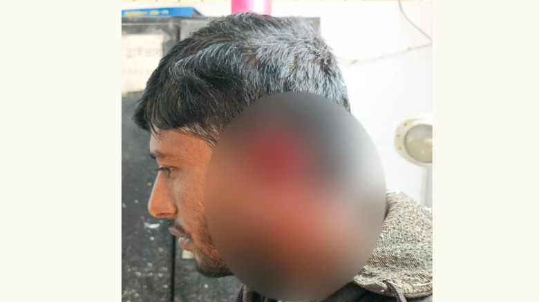 বিএনপি কর্মীর মাথায় ইটের আঘাত, কানের অংশ বিচ্ছিন্ন...