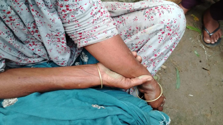 জগন্নাথপুরে তুচ্ছ ঘটনাকে কেন্দ্র করে হামলায় মহিলা ...