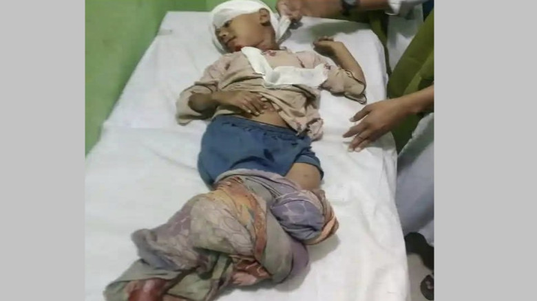 মহেশখালীতে সিএনজির চাপায় পা বিচ্ছিন্ন হয়ে যাওয়া শি...