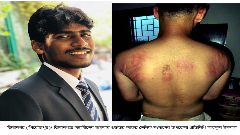 জিয়ানগরে সাংবাদিকের উপর সন্ত্রাসী হামলা, গুরুতর আহ...