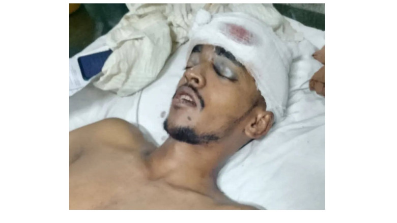 আমতলীতে ধানের কুড়া ক্রয়ের ১শত টাকার বিরোধে হামলায় ...