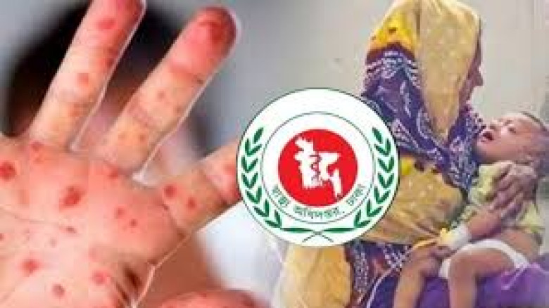 হামের উপসর্গ নিয়ে আরও পাঁচজনের মৃত্যু...