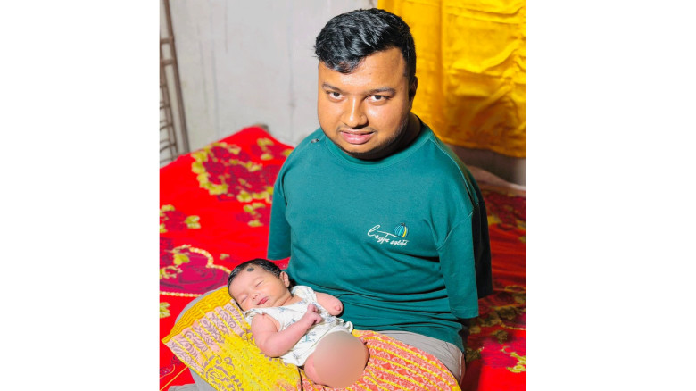 জন্মগতভাবে দুই পা ও একটি হাতবিহীন নবজাতকের পাশে দা...