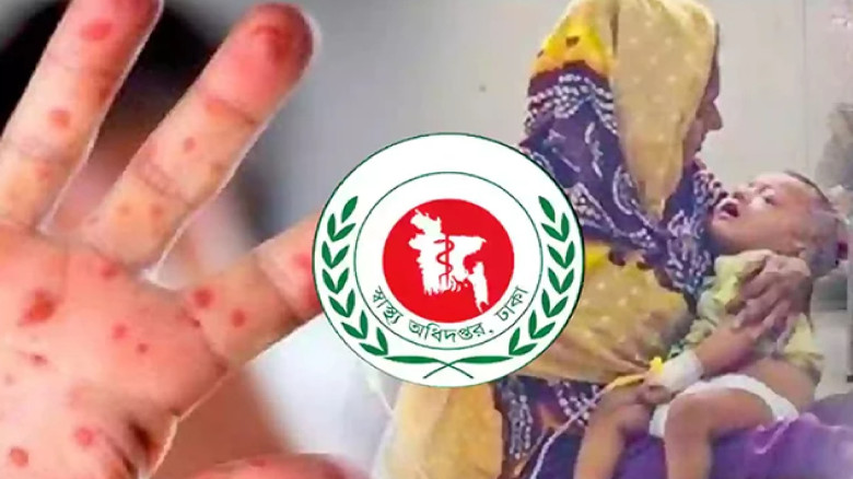 হামের উপসর্গ নিয়ে আরও ১২ শিশুর মৃত্যু...