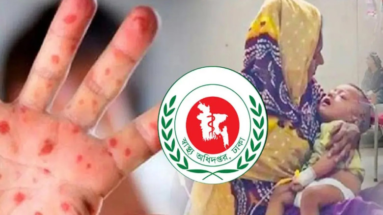 হামের উপসর্গ নিয়ে আরও ৯ শিশুর মৃত্যু...