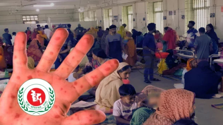 হামের উপসর্গ নিয়ে আরও সাত জনের মৃত্যু...