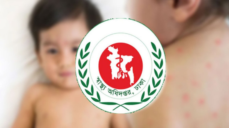 হাম ও হামের উপসর্গ নিয়ে প্রাণ হারাল আরও ১২ শিশু...