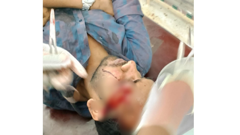 টিউশনিতে যাওয়ার পথে রাবি শিক্ষার্থীর উপর অটোচালকের...