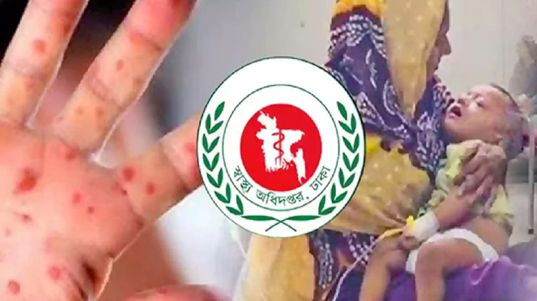 সিলেটে হামের উপসর্গ নিয়ে আরও পাঁচ শিশুর মৃত্যু...