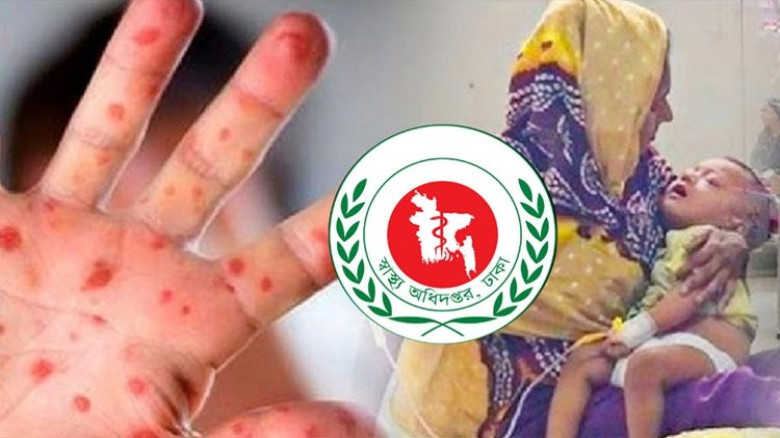 হামের উপসর্গ নিয়ে আরও ১৬ শিশুর মৃত্যু...