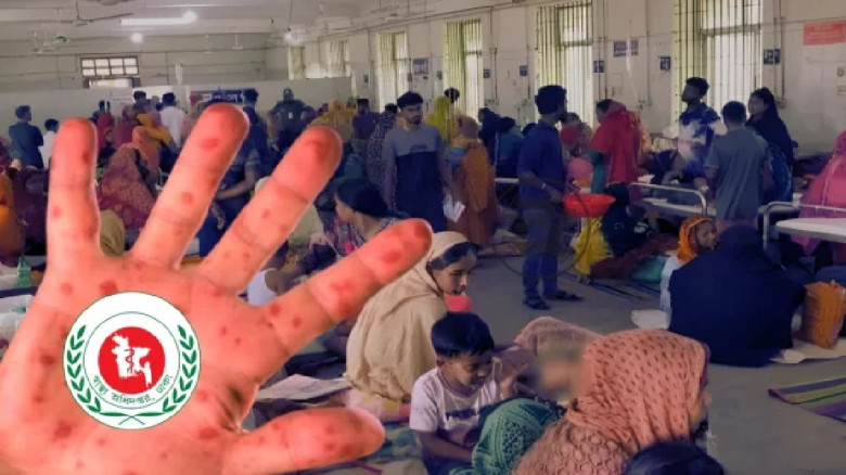 হামের উপসর্গ নিয়ে আরও ছয় শিশুর মৃত্যু...