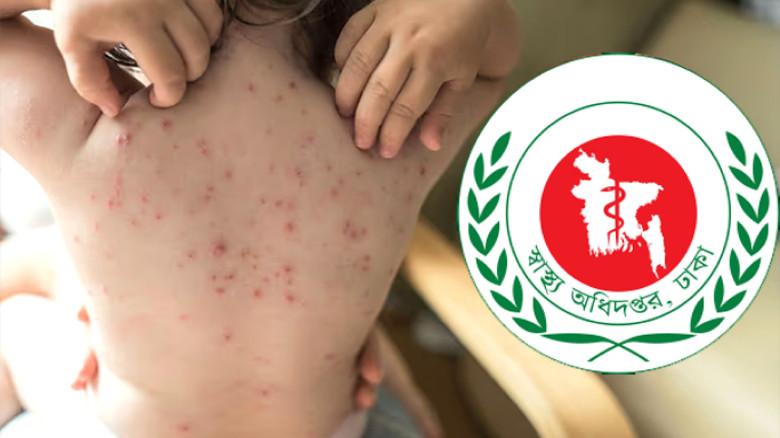 হামে আরও সাত শিশুর মৃত্যু...
