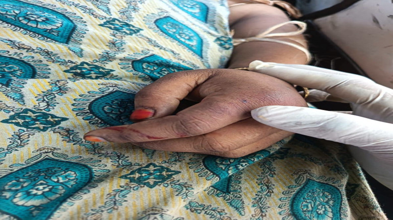 কালকিনিতে লাকড়ির স্তূপে লুকিয়ে থাকা বিষধর সাপের ছো...