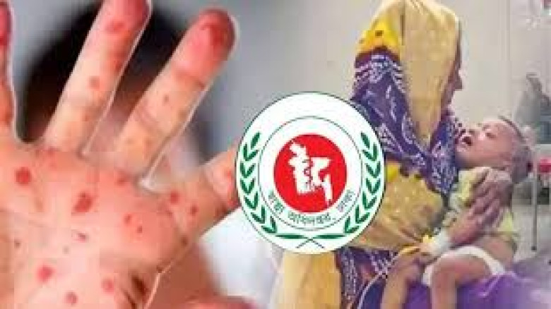 হাম উপসর্গে আরও তিন শিশুর মৃত্যু...