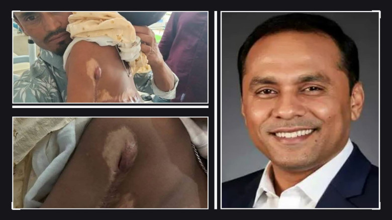 আগুনে দগ্ধ শিশুর চিকিৎসার দায়িত্ব নিলেন ভারপ্রাপ্ত...